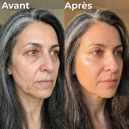 Rides atténuées, peau plus ferme en 4 semaines