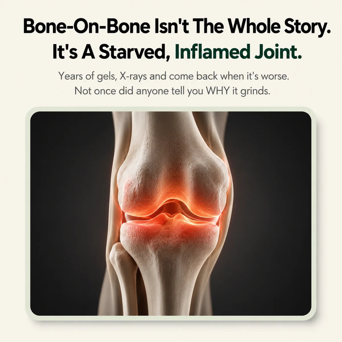 Calm the Grinding, Stiff, Bone-on-Bone Knee Pain in 15 Minutes, Without a Single Side Effect, Or Your Money Back