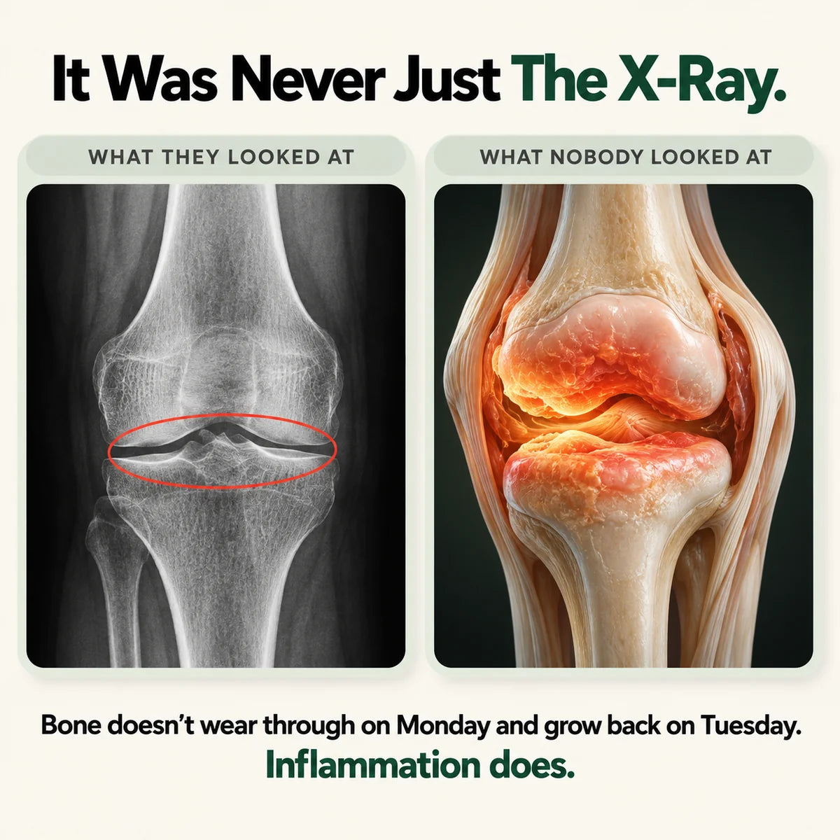 Calm the Grinding, Stiff, Bone-on-Bone Knee Pain in 15 Minutes, Without a Single Side Effect, Or Your Money Back